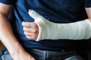 broken-thumb-symptoms-treatment-recovery
